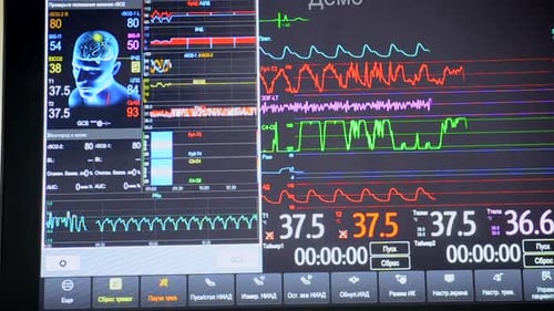 Modern Patient Monitor