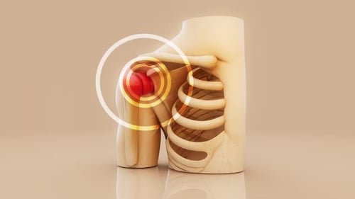 3D Animation of Human Shoulder Pain and Inflammation