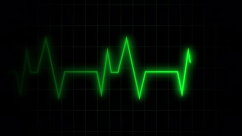 Seamless Loop Grüne EKG-Herzschlagwellenform