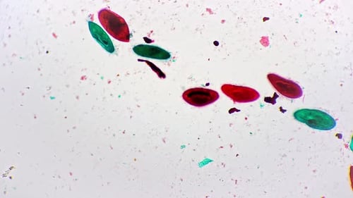 Paramecium Ganzkörperhalterung unter dem Mikroskop, 100-fach vergrößert gegen helles Feld