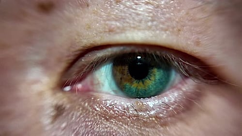 Nahaufnahme des ungewöhnlichen zweifarbigen Auges eines weißen Mannes.