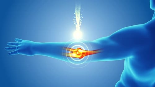 Futuristic Medical Animation of Human Arm Joint Pain