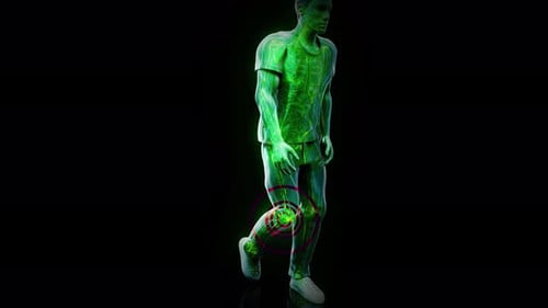 3D Human Anatomy Walking with Knee Pain Medical Visualization