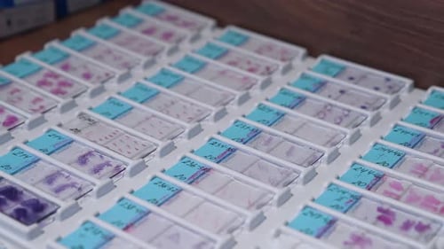 Rows of Labeled Pathology Slides on White Tray