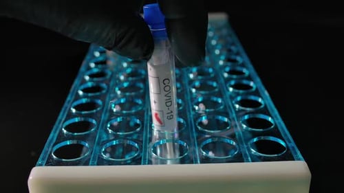 COVID-19 Test Tube Placed in Rack