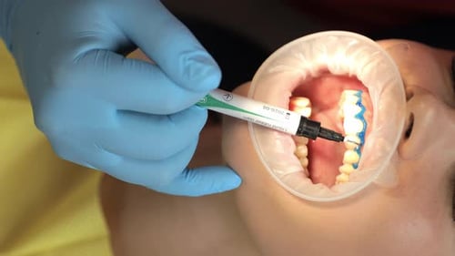 Dentist Applying Dental Dam to Patient's Teeth