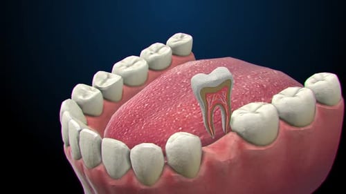 3D Dental Animation of Tooth Extraction and Internal Structure
