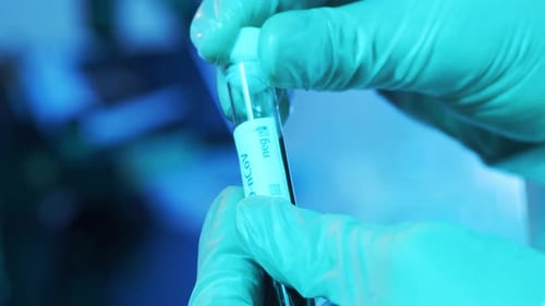 Blut und Viren im Laborröhrchen Nahaufnahme eines wissenschaftlichen Labors in Kliniken Pandemieerkrankung
