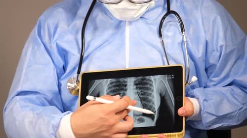 Doctor Shows Chest Area Xray