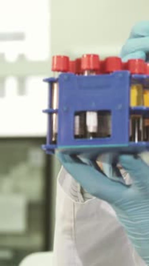 Medical Technician Holding Test Tubes in Hospital Lab