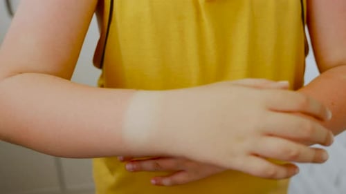 Un enfant tourne son avant-bras avec un coup de soleil et une tache pâle en gros plan