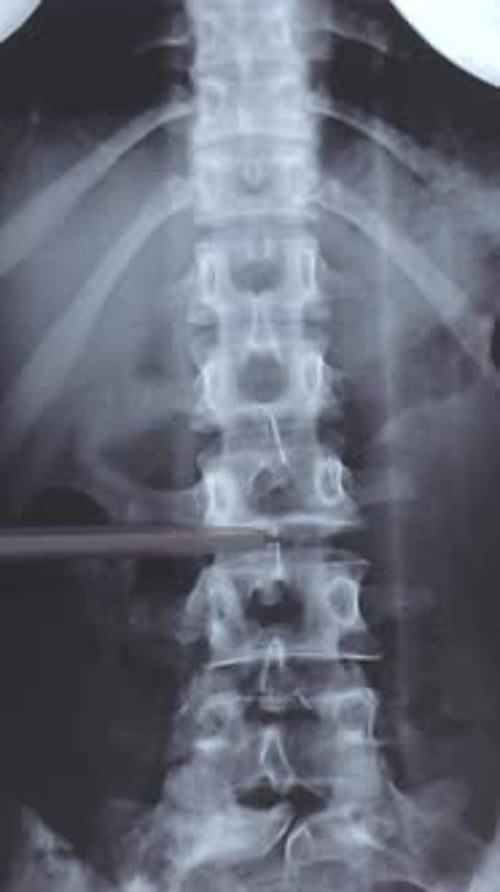 Doctor learn vertical MRI or CT image