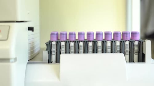 A row of blood sample vials with purple caps inside a medical laboratory testing