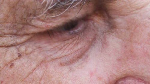 Extreme Close-Up of an Eye and Wrinkled Skin