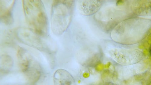 Población de alta densidad de paramecio en campo brillante al microscopio