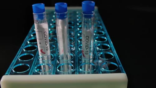 COVID-19 Test Tubes in Blue Rack