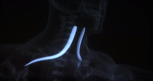 Omohyoid muscle in human body. X Ray. Loop