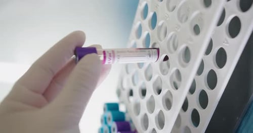 Placing Blood Sample in Test Tube Rack