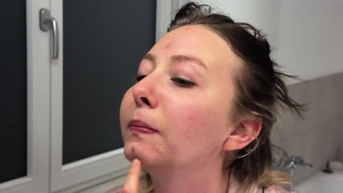 Woman Checking Pimples in Mirror Close-Up Skin Care