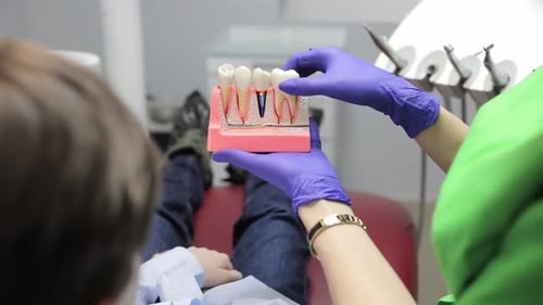 Dental Demonstration with Tooth Model in Clinic