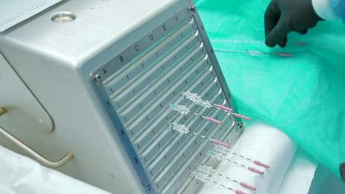 Close Up of Medical Procedure at the Hospital with Special Equipment