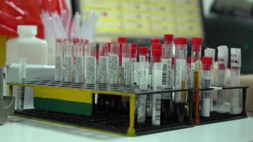 Blood Samples in Test Tubes in Lab