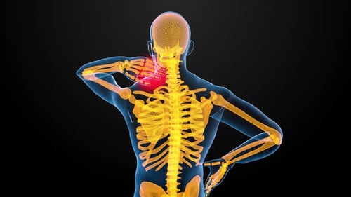 Animated Human Skeleton Anatomy with Highlighted Pain Points