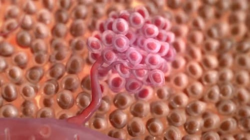 Close-up of a pink tumor growing on a cellular structure