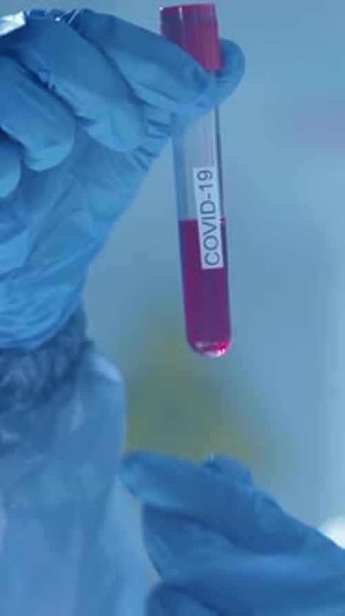 Close-up of Unrecognizable Scientist Examining Test Tube with Blood Sample