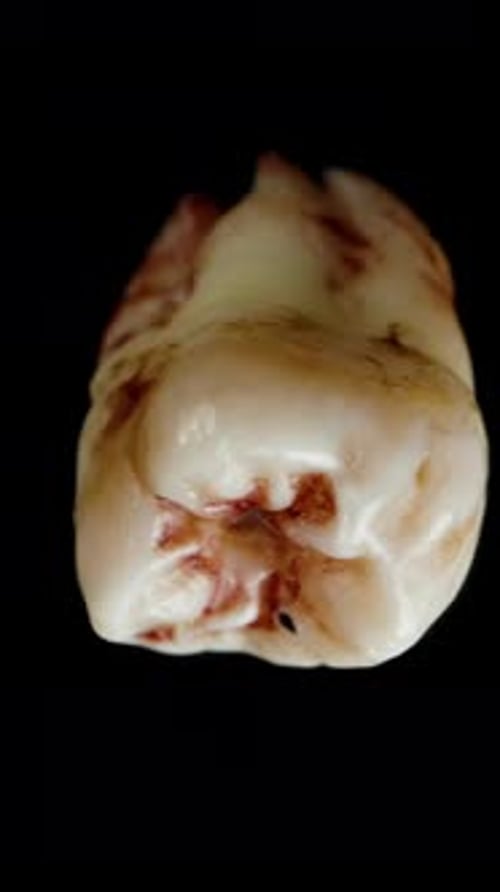 Vertical video. Human Tooth in Blood Spins and Falls Down. Macro Super Slow Motion. Isolated.