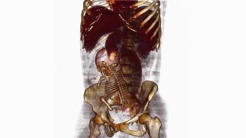 3D Render of Fetus and Maternal Skeleton Medical Scan