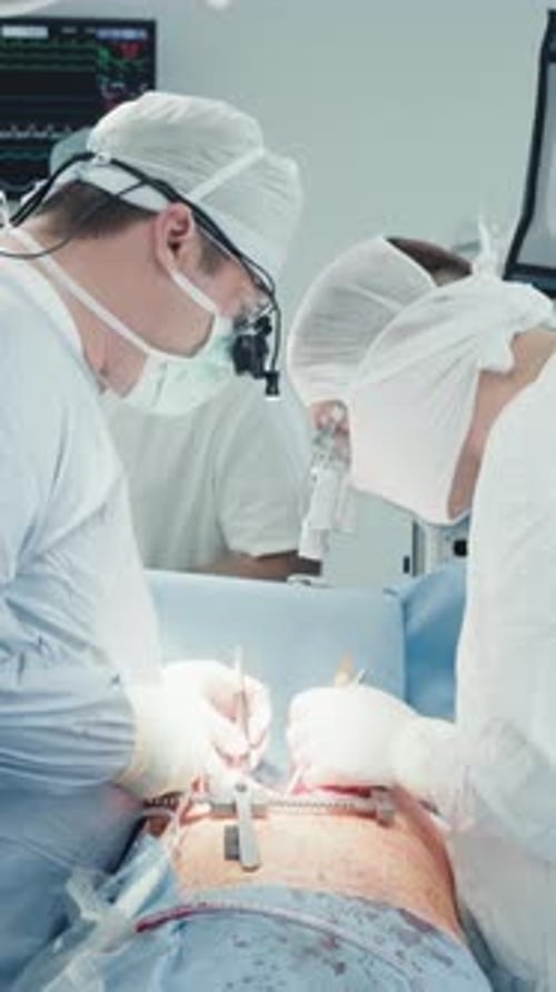 Doctors Performing a Medical Operation in Hospital Setting