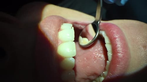 Dental Care Extreme Close Up Macro Video Dentist Treat Patient Teeth Orthodontist Works with