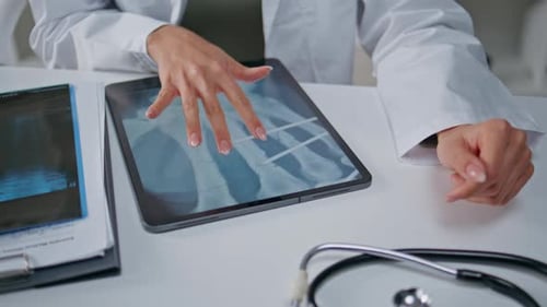 Arzt berührt Röntgenbild auf Tablet in Klinik-Nahaufnahme Arzt untersucht