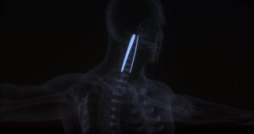 Longus Capitis Muscle