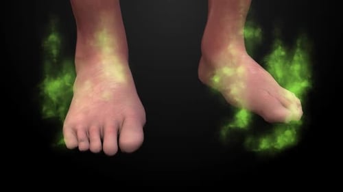 Metatarsalgia or Ball of Foot Pain