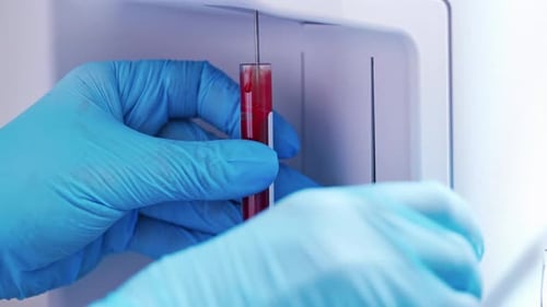 Blood Sample Analyzed by Medical Professional
