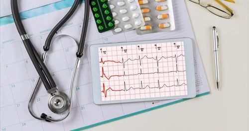 Gestión de la salud cardíaca: interpretación de las lecturas del ECG y los cronogramas de medicación