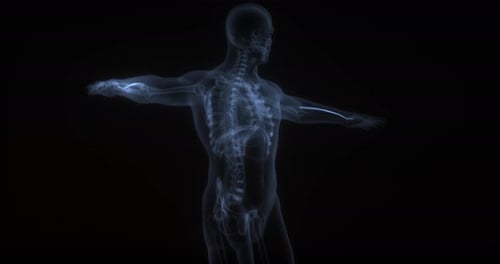 Musculus extensor carpi radialis longus im menschlichen Körper. Röntgenbild. Schleife