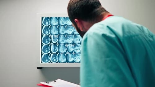 Close-up shot a radiologist carefully examines the MRI image on special board and describes he saw