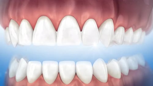 Realistic 3D Animation of Dental Implant Installation