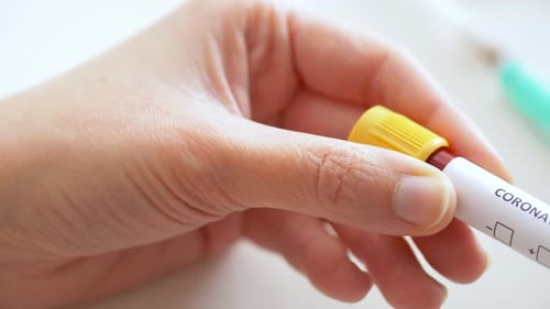 Close Up of Blood Sample in Vial