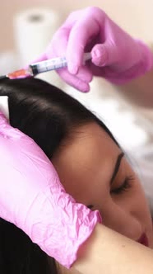 Injections for healthy hair growth. Mesotherapy. Aesthetic cosmetology Vertical video