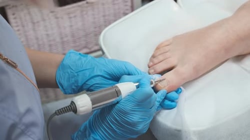 Toe Treatment in Foot Clinic with Technician