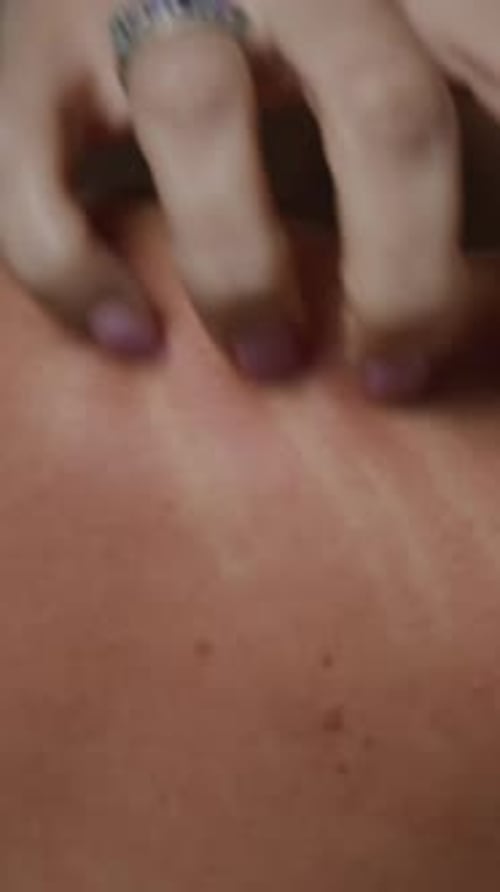 Vertical of Unrecognizable Woman Suffering from Itchy Skin