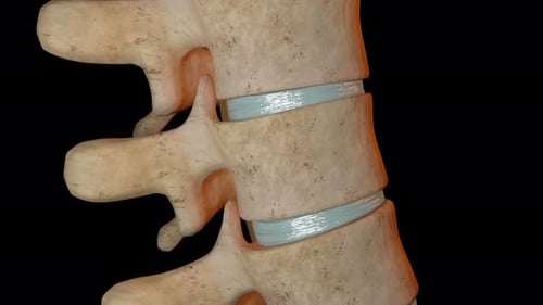 Human spinal column segment showing compression of the intervertebral disc