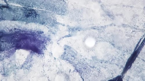 Whole Mount of Human Motor Nerve Endings in the Pattern Filmed Under Microscope 400x