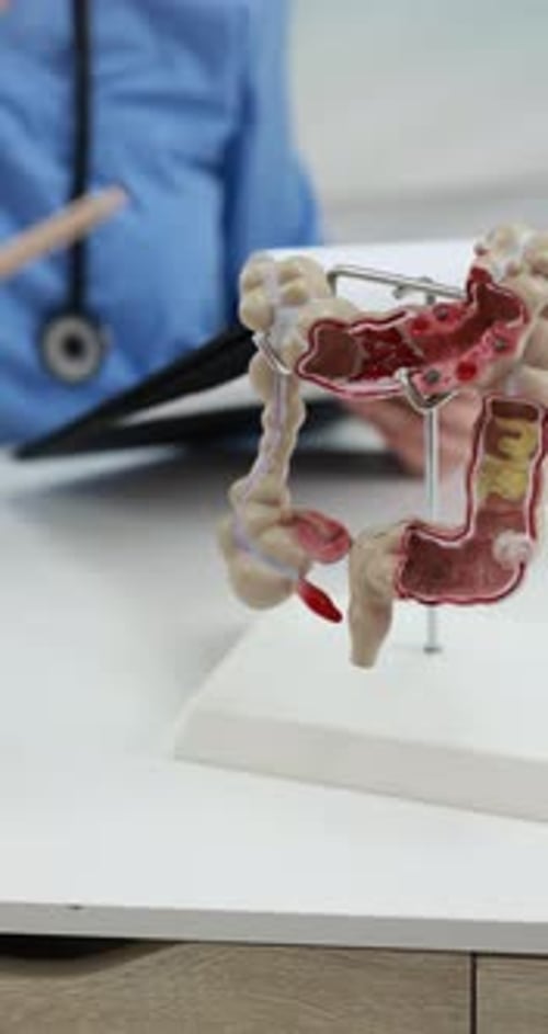 Gastroenterologe zeigt Dickdarmmodell am weißen Tisch in der Klinik. Kamera bewegt sich