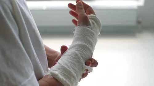 Seitenansicht der Nahaufnahme Abgeschnittene Aufnahme eines nicht wiederzuerkennenden kleinen Mädchens mit gebrochener Hand in Weiß gehüllt