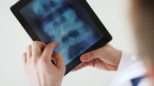 Arzt analysiert Röntgenbild auf Tablet